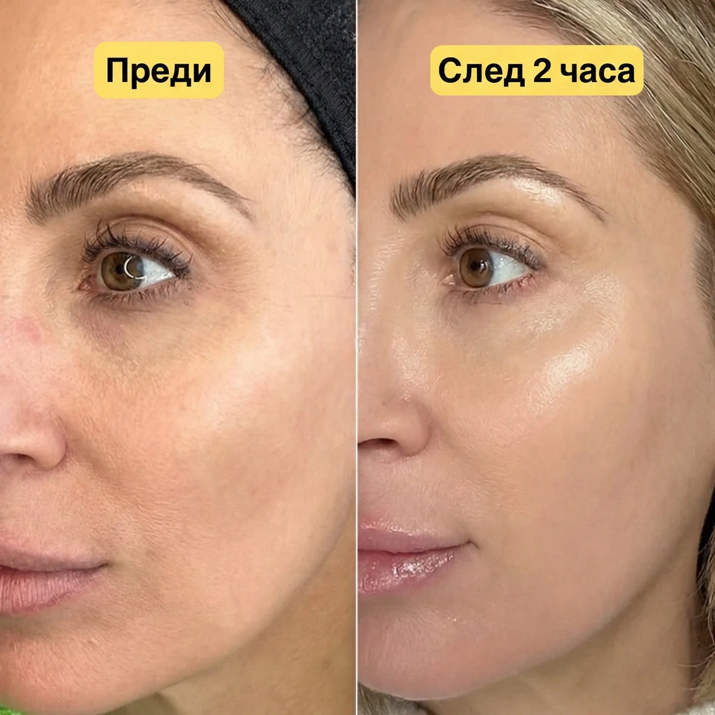 Нощна Гел Маска с 96% Муцин от Охлюви